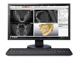 歯科用CT
